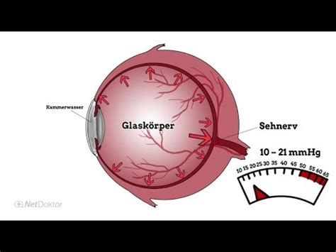 Wie entsteht Grüner Star? - NetDoktor.de - YouTube