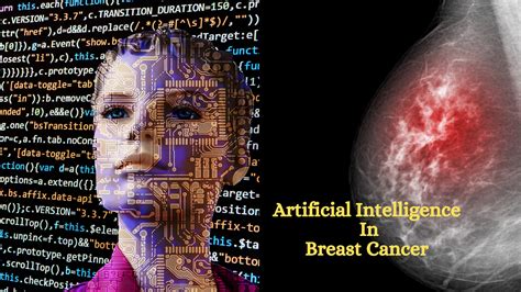 Will artificial intelligence find and cure breast cancer?