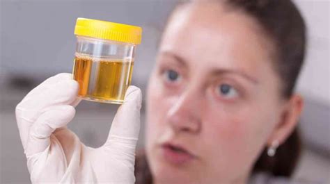 Pyridium Makes Urine Orange. Phenazopyridine (Pyridium) is essentially a dye that soothes the lining of the urinary tract. In most people, it darkens the color of the urine to an orange or red color. This is not harmful and is expected with the use of phenazopyridine. However, it may cause permanent stains on underwear.. 