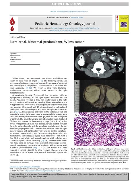 Wilms Tumor Article - StatPearls