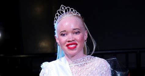 Winner of albinism pageant says Zimbabwe event made her feel beautiful and provided sense of purpose