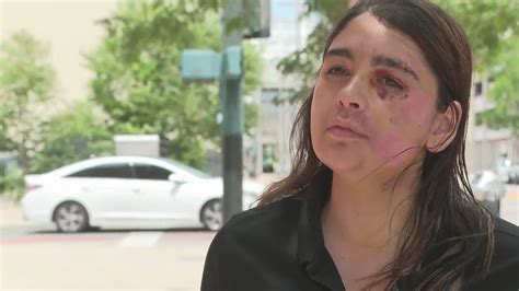 Woman injured in scooter crash warns others