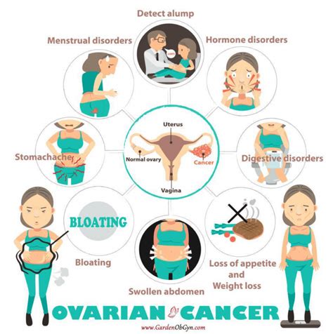 Women's Health Wednesday: Ovarian Cancer