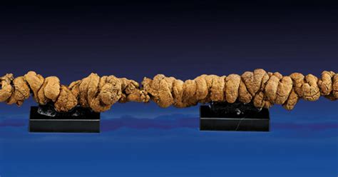 World's longest human poop. Things To Know About World's longest human poop. 