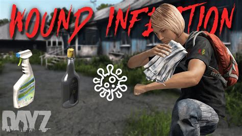 This is a guide for configuring Dayz Medical Attention Mod. Configuration is optional for server owners who want to disable specific features or modify some parameters. So this mod is simply installed on server side like any other mod by copying the @MedicalAttention folder to the root of server files. To create a configuration copy the .... 