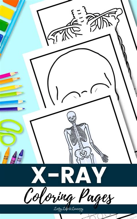 X Ray Coloring Shee