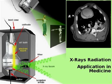 X ray rad vision service manual. - Study guide for fundamentals of nursing 8th edition.