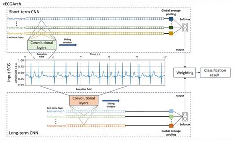 xECGArch: a trustworthy deep learning architecture for interpretable ... - coolestguyplanet.net