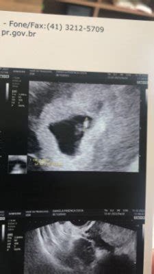 Xitsdanix Onlyfans Leak 💋 XxX