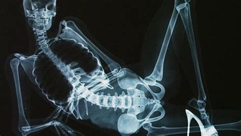 Xray porn. Things To Know About Xray porn. 