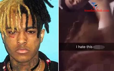 The autopsy report of the late rapper and singer Xxxtentacion revealed a colon that was 5-6 inches in diameter and 8-9 feet long. He was shot multiple times and …