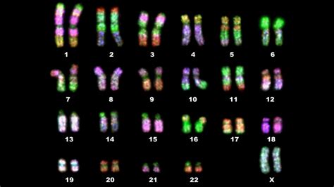 Y kromozomu mikrodelesyon analizi