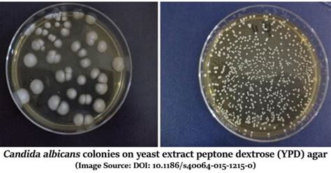 YEPD Agar- Composition, Principle, Preparation, …