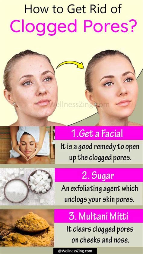 Your Ultimate Guide: How to Get Rid of Clogged Pores for Good - balustradellc