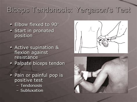 Yergason Test PT Master Guide