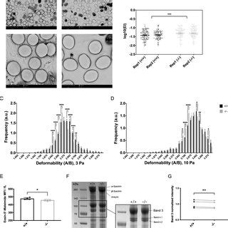 Yippee like 4 (Ypel4) is essential for normal mouse red blood cell ...