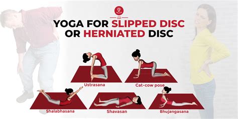 Yoga For Slipped disc or herniated disc: 5 Yoga Poses To Treat