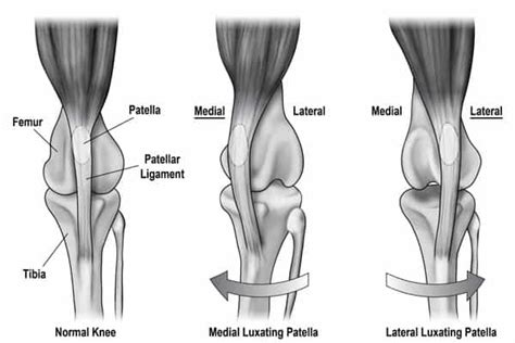 Your Guide to Patellar Luxation in Dogs (Wobbly Kneecaps)