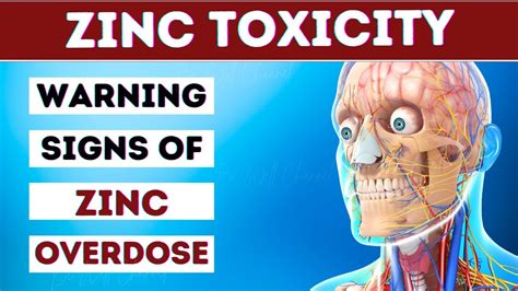 Zinc toxicity - WikEM