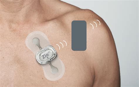 Zio heart monitor flashing red. Things To Know About Zio heart monitor flashing red. 