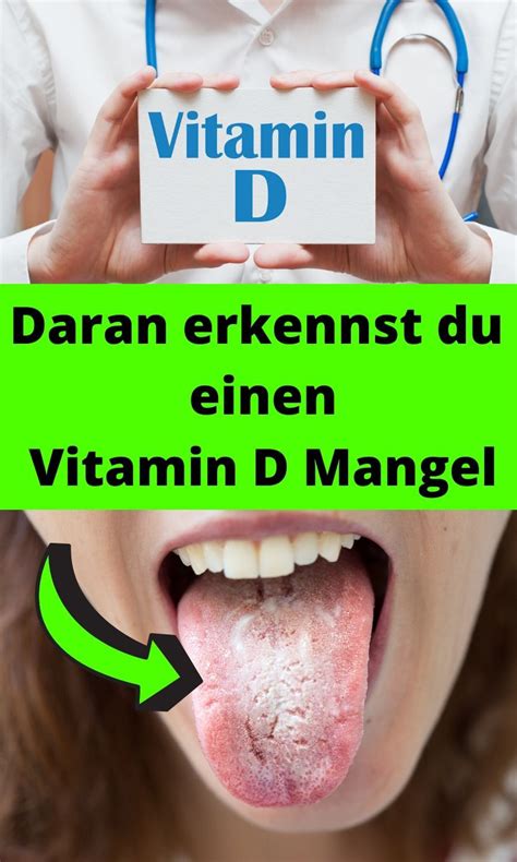 Zu viel vitamin d nebenwirkungen