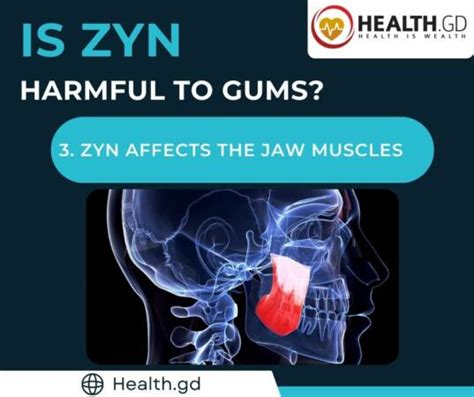 Side Effects of Nicotine Pouches & ZYN: What to Know
