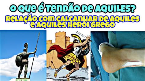 A Canção De Aquiles