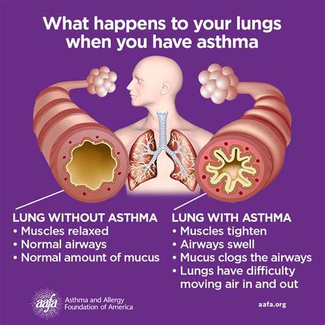 a cure for asthma what your doctor isn t telling