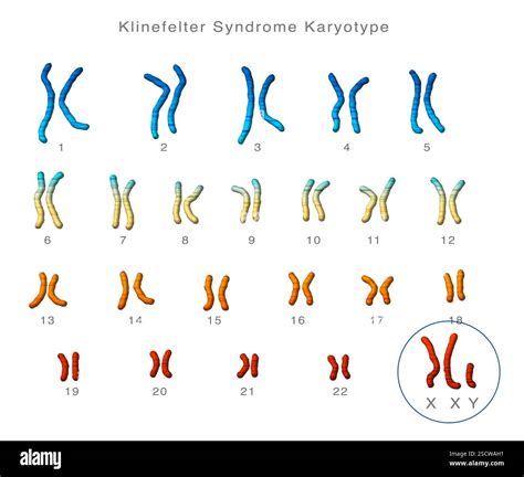 A Karyotype Would Be Unable To Determine