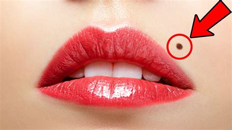 A Mole On Lip