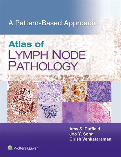 a pattern approach to lymph node diagnosis