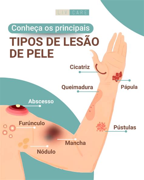 A Pele Em Que Hábito
