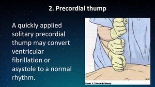 A Precordial Thump
