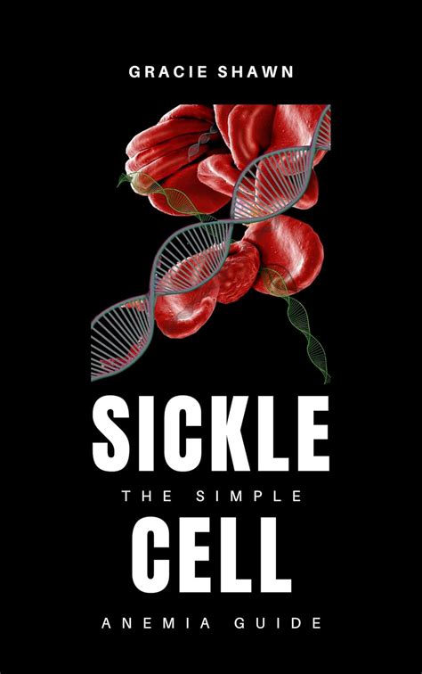 A Simple Guide To Sickle Cell Anemia Treatment And Related Diseases A Simple Guide To Medical Conditions
