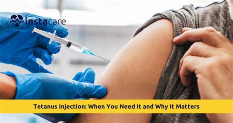 A Tetanus Injection Would Be Coded From