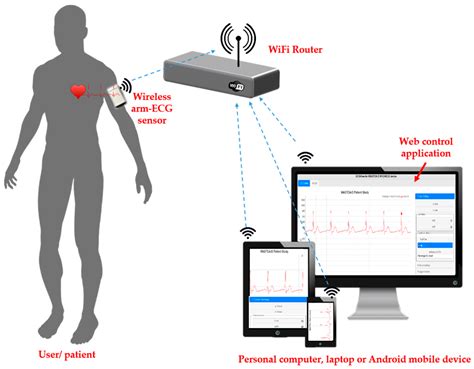 A Wireless Wearable Ecg Sensor For Long Term Applications