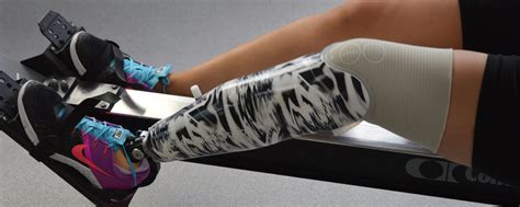 Read Online A Novel Approach For Customized Prosthetic Socket Design 