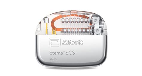 Abbott Eterna Charging Instructtions