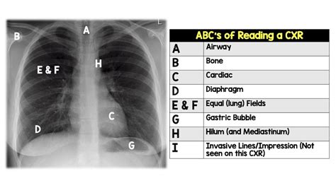 Abc And Number X Ray Abc And Number Chart - Abc And Number Chart