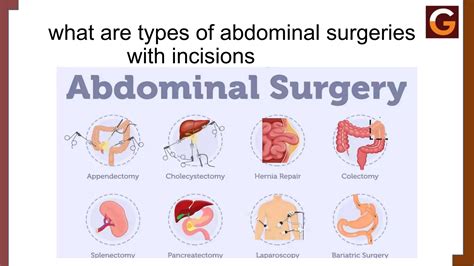 Abdominal Surgery Types