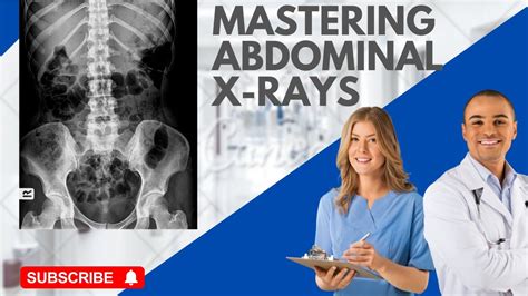 Abdominal X Rays Made Easy International Edition S