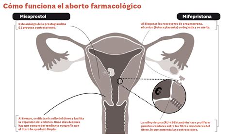 aborto quimico cuidados
