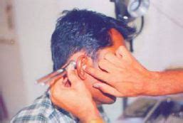 Absolute Bone Conduction Test