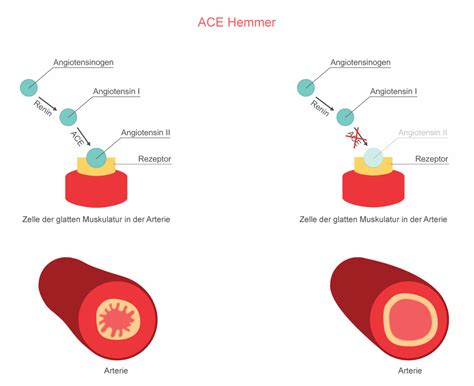 ace hemmer oder betablocker
