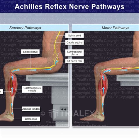 Achilles Tendon Reflex Nerve Root