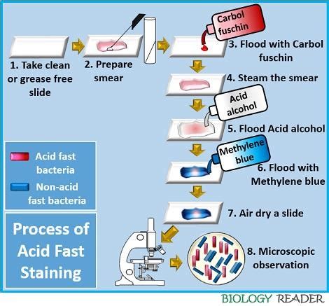 Acid Fast Staining Procedure