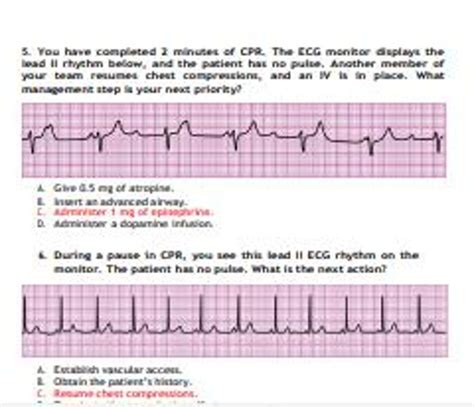 Acls Exam Version C