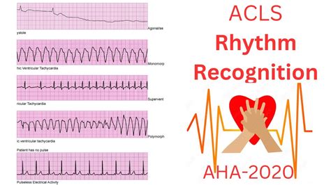 Acls Practice Rhythms