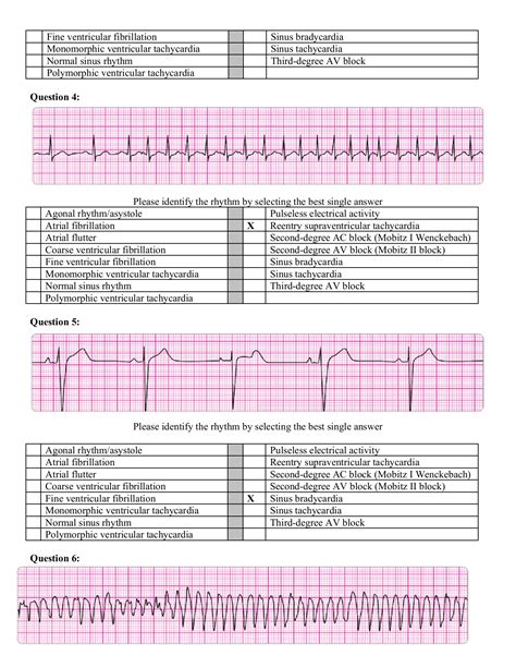 Read Acls Pretest 2014 Question And Answer 