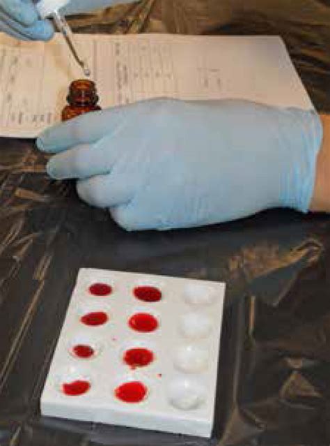 Activity Investigating Blood Types Teachervision Blood Types Worksheet Middle School - Blood Types Worksheet Middle School